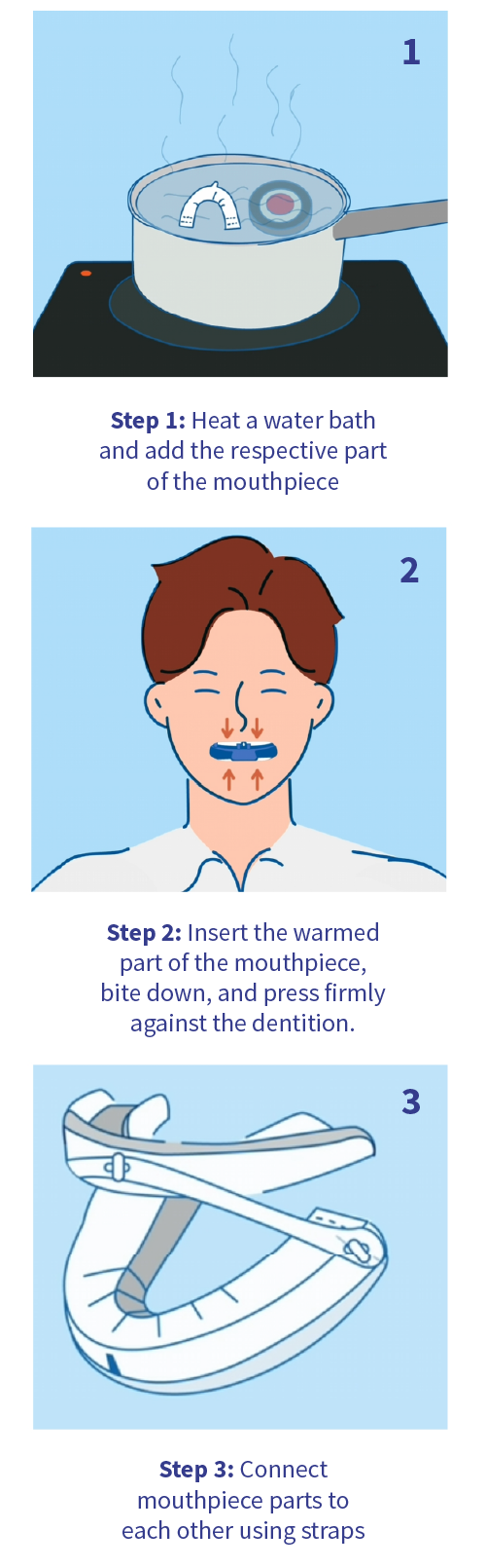 Fitting a snoring mouth guard
