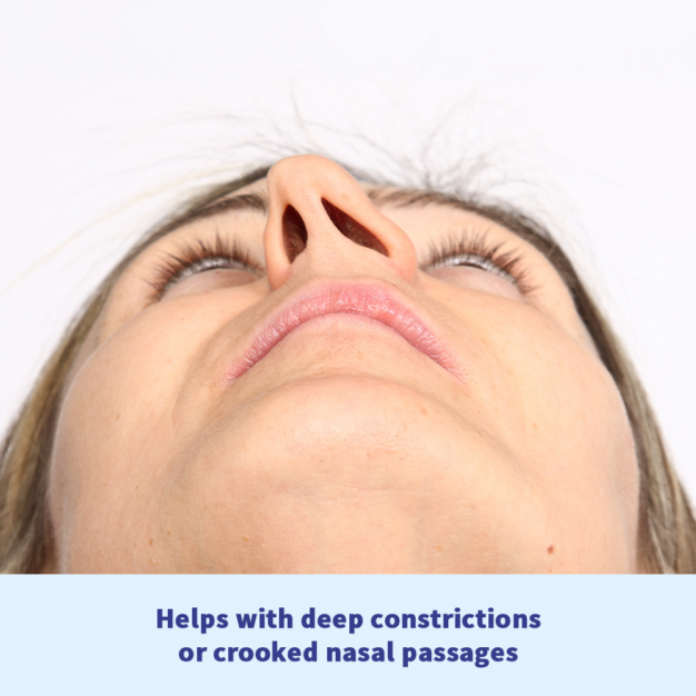 somnipax air Nasal Dilator - For deep constrictions and crooked passages