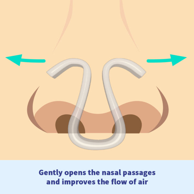 somnipax air Nasal Dilator - Gently opens the nasal passages